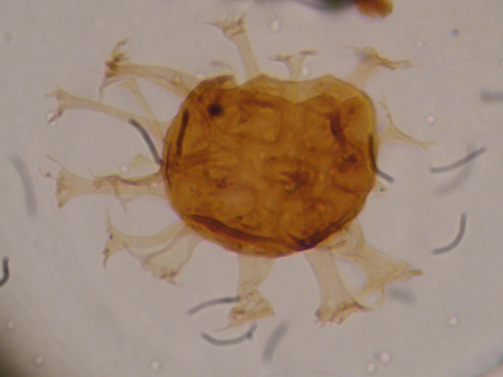 Hystrichosphaeridium salpingophorum.JPG